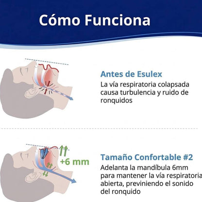 Bucal Anti-Ronquidos